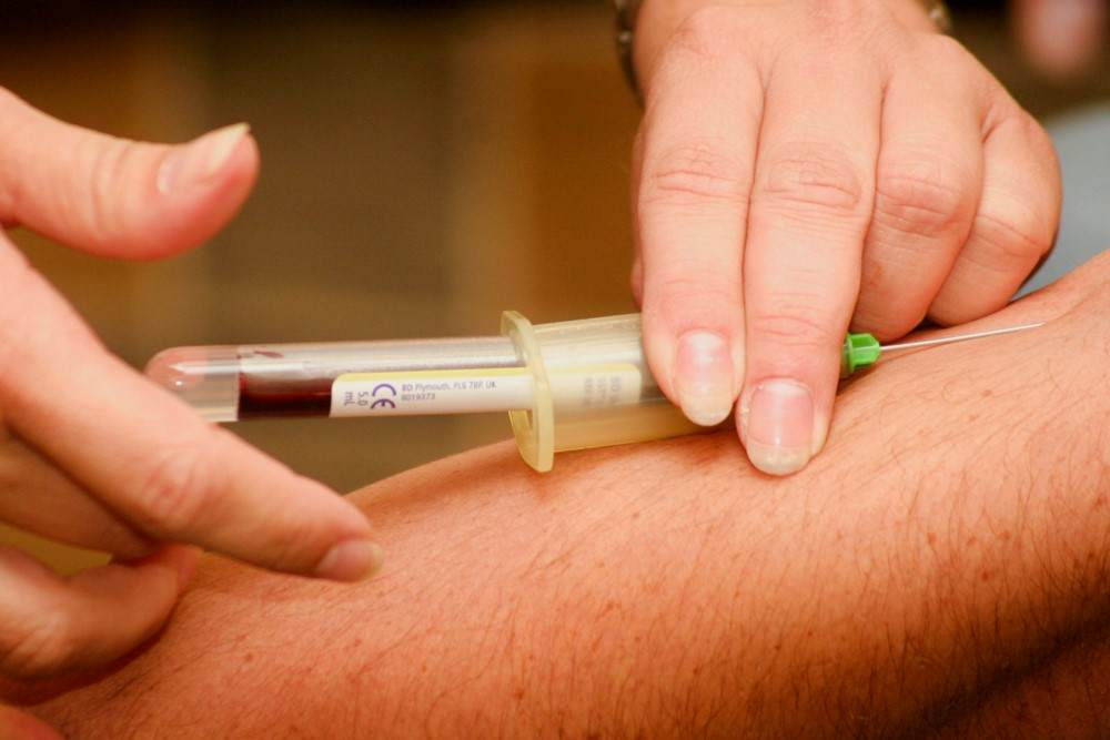 Prise de sang pour recherche taux de tcmh bas ou élevé