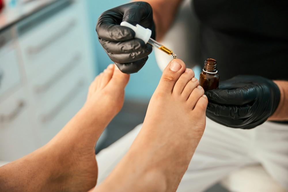 Personne en soins pour mycose ongle pied traitement huile essentielle tea tree