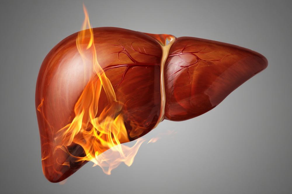 Foie malade, bilirubine élevée