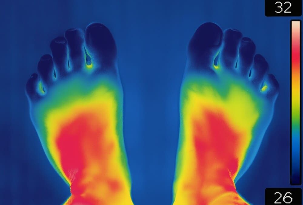 Thermographie infrarouge pied diabétique