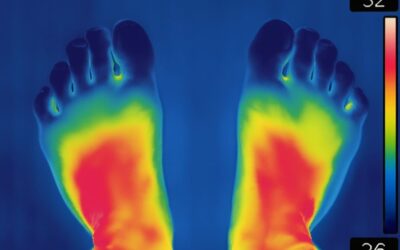 Thermographie infrarouge et intelligence artificielle : prévenir les ulcères du pied diabétique