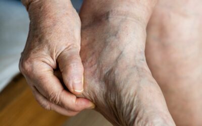 Ulcère du pied diabétique : Comment le reconnaître et éviter les complications ?