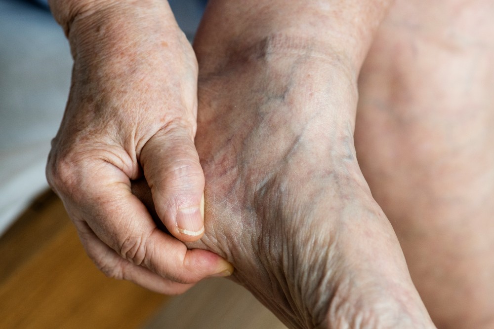 Mal au talon, ulcère du pied diabétique, neuropathie