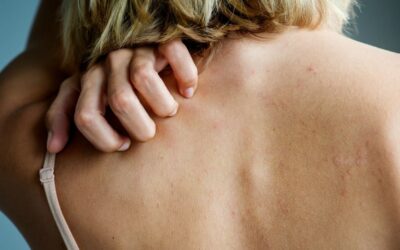 Démangeaisons sans boutons : Pourquoi ça gratte et quand s’inquiéter ?