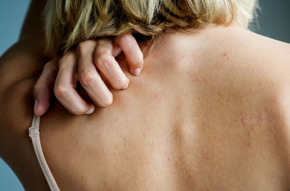 Femme qui se gratte le dos démangeaisons sans boutons