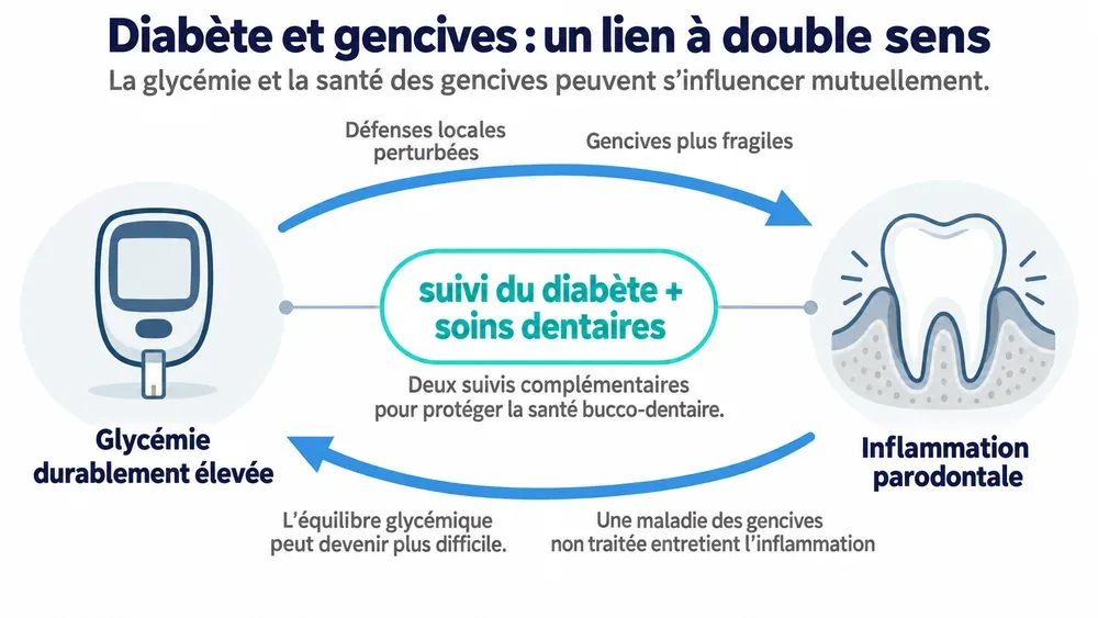 Diabète et gencives : un lien à double sens. La glycémie et la santé des gencives peuvent s’influencer mutuellement.